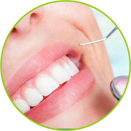 Imagen para la categoría Blanqueamiento dental láser