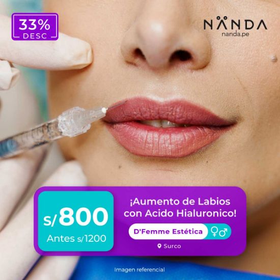 ¡Aumento de Labios con Acido Hialuronico ! 😍 - D'Femme Estética (SURCO)