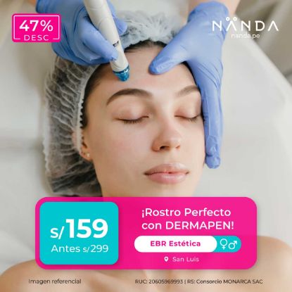 ¡Rostro Perfecto con DERMAPEN! 😍 - EBR Estética (SAN LUIS)