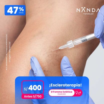 ¡Escleroterapia! 😍 - D'Femme Estética (SURCO)