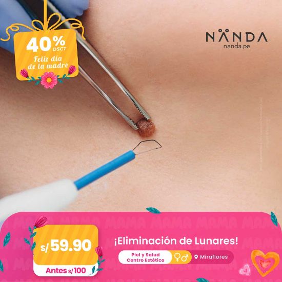 ¡Eliminación de Lunares! 😍 - Piel y Salud Centro Estético (MIRAFLORES)