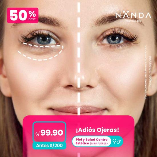 ¡Adiós Ojeras! 😍 - Piel y Salud Centro Estético (MIRAFLORES)