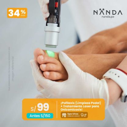 ¡Pofilaxis (Limpieza Podal) + Tratamiento Laser para Onicomicosis! 😍 - Spa Uñas (MIRAFLORES)
