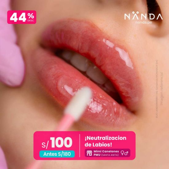 ¡Neutralización de Labios  😍 - Mimi Canelones PMU (SANTA ANITA)