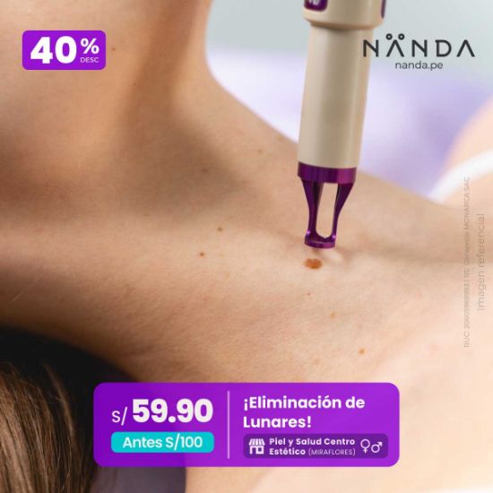 ¡Eliminación de Lunares! 😍 - Piel y Salud Centro Estético (MIRAFLORES)