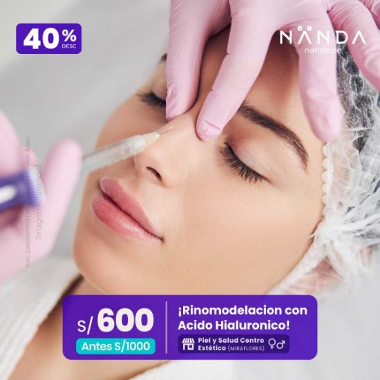 ¡Rinomodelacion con Acido Hialuronico! 😍 - Piel y Salud Centro Estético (MIRAFLORES)