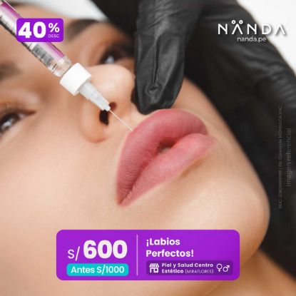 ¡Labios Perfectos! 😍 - Piel y Salud Centro Estético (MIRAFLORES)