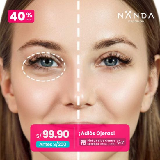 ¡Adiós Ojeras! 😍 - Piel y Salud Centro Estético (MIRAFLORES)