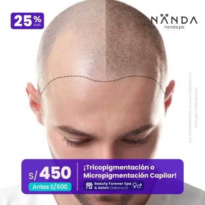 ¡Tricopigmentación o Micropigmentación Capilar! 😍 - Beauty Forever Spa & Salon (SURQUILLO)