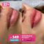 ¡Neutralización de Labios! 😍 - D'Femme Estética (SURCO)