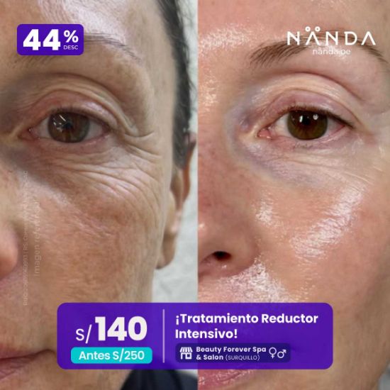 ¡Facial Exosomas + Esperma de Salmón! 😍 - Beauty Forever Spa & Salon (SURQUILLO) 