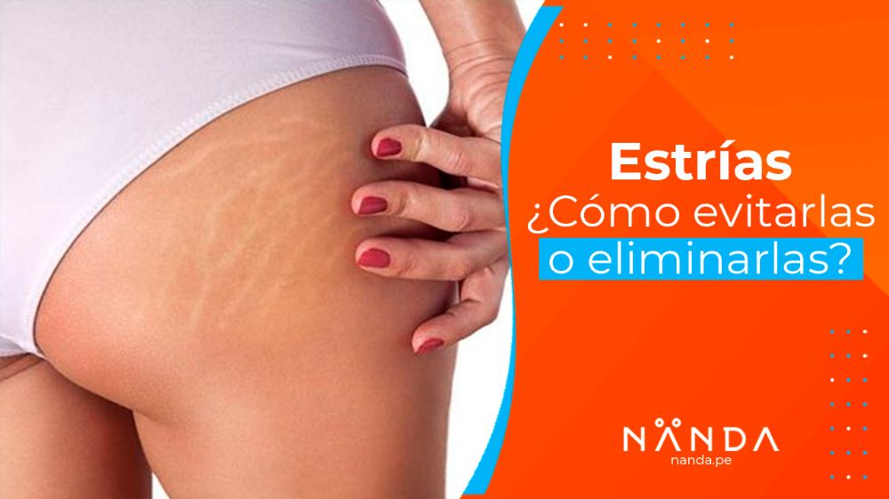 ¿Tienes celulitis? ¡Aquí te decimos qué hacer para combatirla!