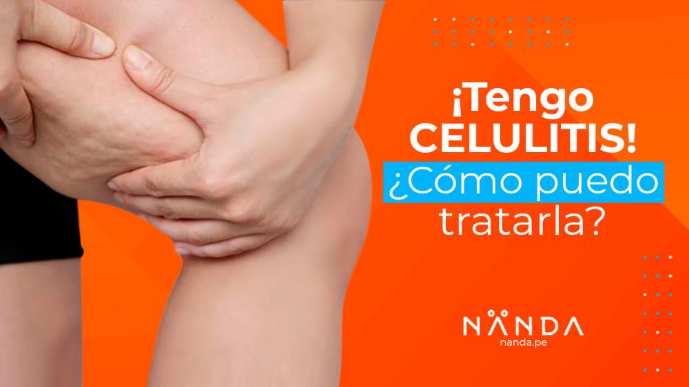 ¿Tienes celulitis? ¡Aquí te decimos qué hacer para combatirla!